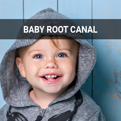 Navigation image for our Baby Root Canal page