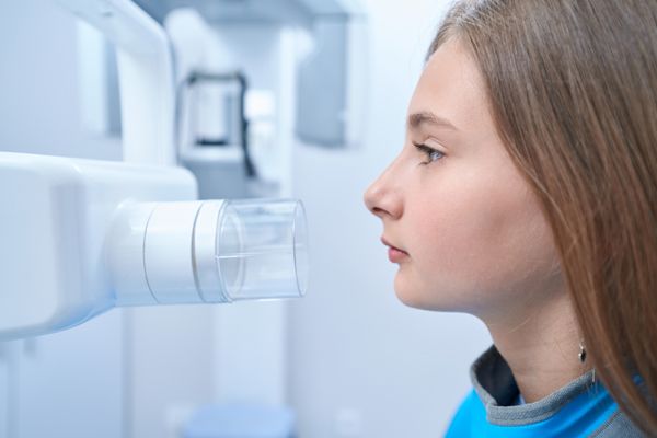 Benefits Of Digital X Rays On Your Dental Visit